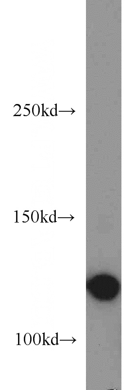 HeLa cells were subjected to SDS PAGE followed by western blot with Catalog No:115382(SMC5 antibody) at dilution of 1:500