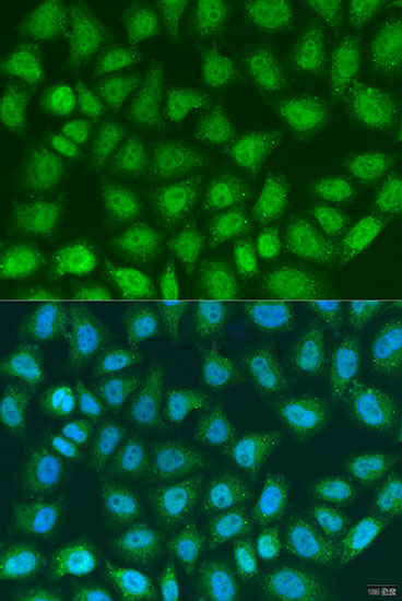 Immunofluorescence - SOCS4 Polyclonal Antibody 