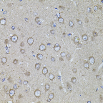 Immunohistochemistry - CRHR1 Polyclonal Antibody 