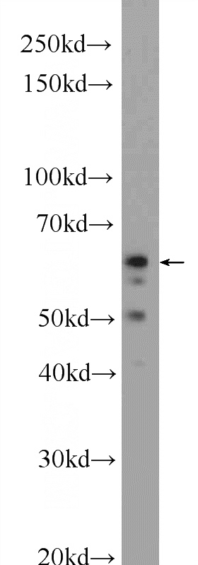 HepG2 cells were subjected to SDS PAGE followed by western blot with Catalog No:112532(MFSD2 Antibody) at dilution of 1:1000