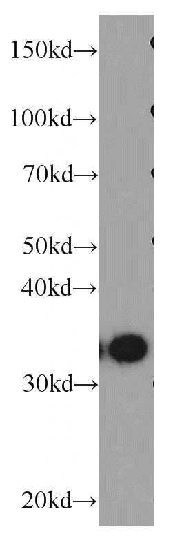 Jurkat cells were subjected to SDS PAGE followed by western blot with Catalog No:111500(HNRNPA1 antibody) at dilution of 1:400