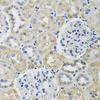 Immunohistochemistry - TUBB8 Polyclonal Antibody 