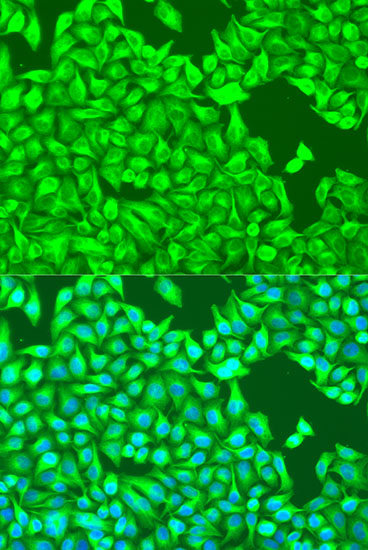 Immunofluorescence - TUBB8 Polyclonal Antibody 