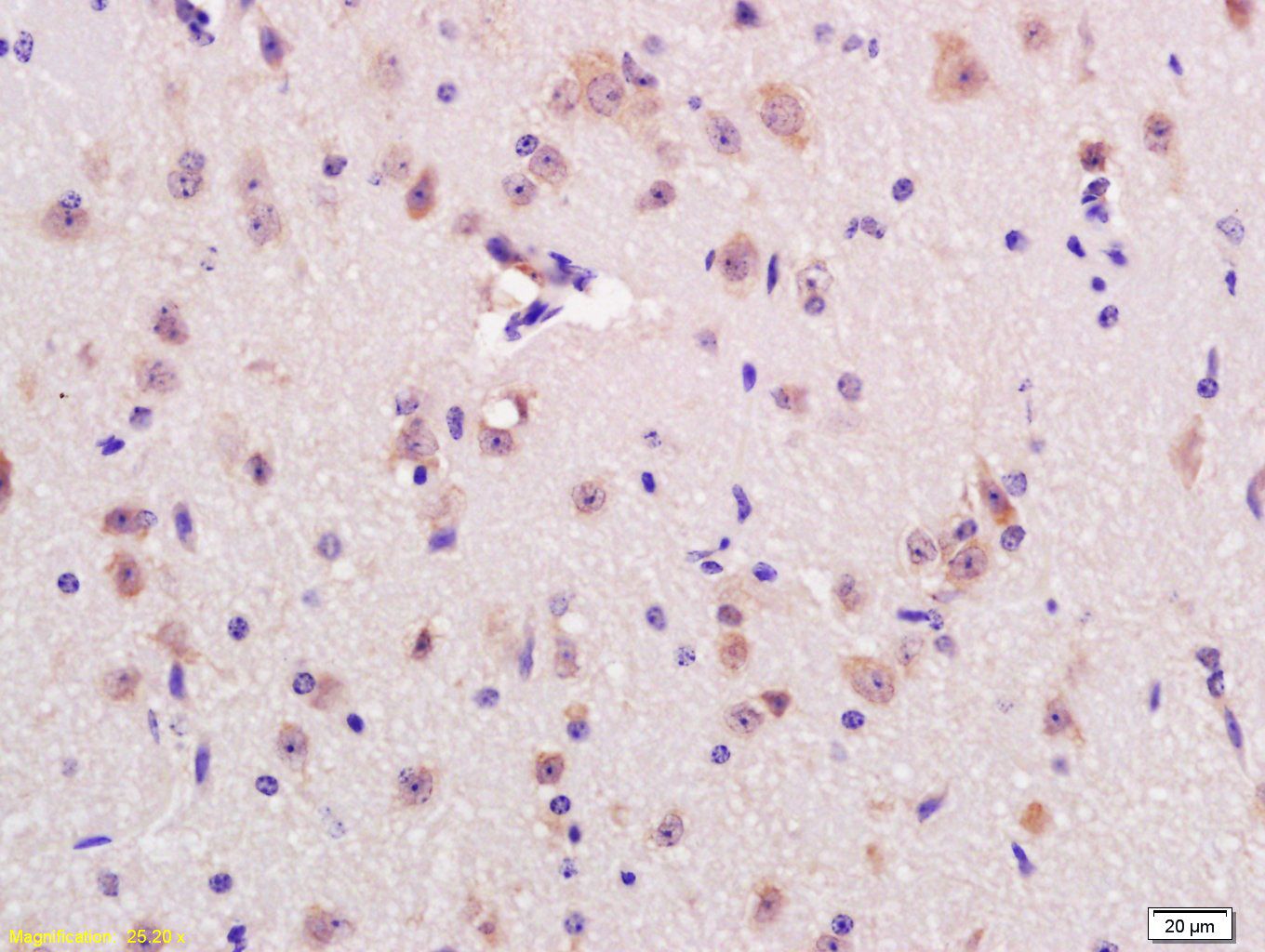Fig1: Tissue/cell: mouse brain tissue; 4% Paraformaldehyde-fixed and paraffin-embedded;; Antigen retrieval: citrate buffer ( 0.01M, pH 6.0 ), Boiling bathing for 15min; Block endogenous peroxidase by 3% Hydrogen peroxide for 30min; Blocking buffer (normal goat serum,C-0005) at 37℃ for 20 min;; Incubation: Anti-RNF123 Polyclonal Antibody, Unconjugated 1:200, overnight at 4℃, followed by conjugation to the secondary antibody(SP-0023) and DAB(C-0010) staining
