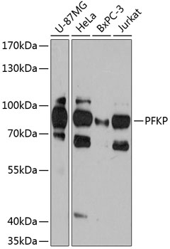 Western blot - PFKP Polyclonal Antibody 