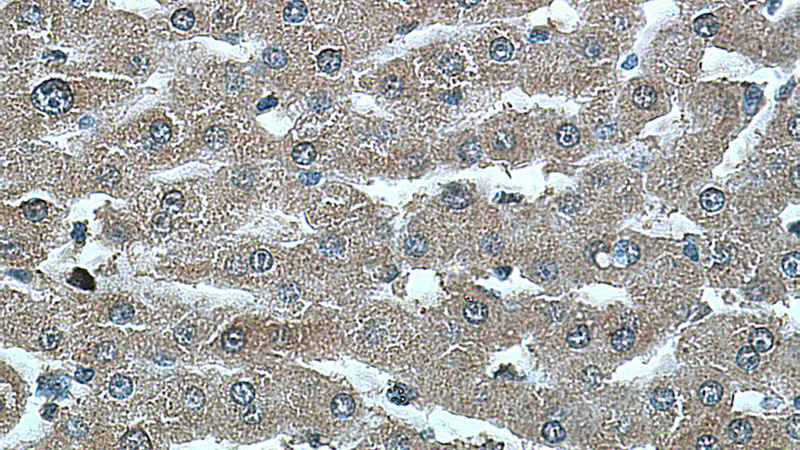 Immunohistochemistry of paraffin-embedded human liver tissue slide using Catalog No:107465(PEX5 Antibody) at dilution of 1:200 (under 40x lens).