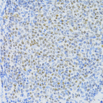 Immunohistochemistry - SNRNP70 Polyclonal Antibody 