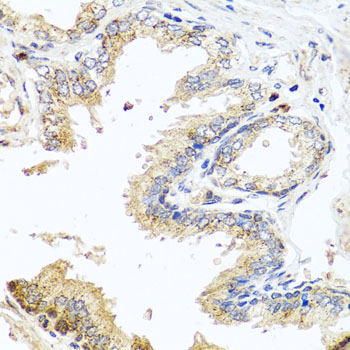 Immunohistochemistry - MCCC2 Polyclonal Antibody 