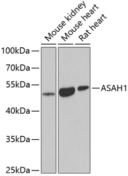 Western blot - ASAH1 Polyclonal Antibody 