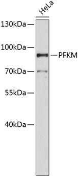 Western blot - PFKM Polyclonal Antibody 