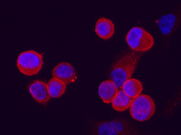 C4.4A / LYPD3 Antibody, Rabbit MAb, Immunofluorescence