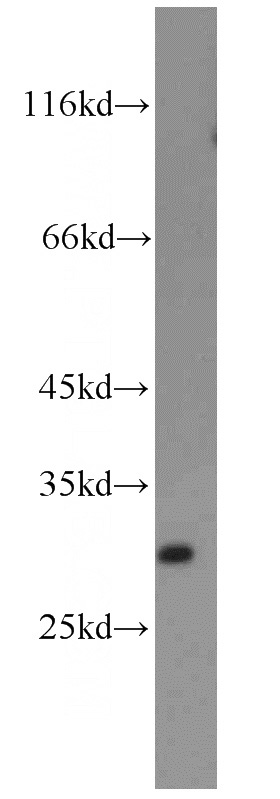 HL-60 cells were subjected to SDS PAGE followed by western blot with Catalog No:114254(PSPH antibody) at dilution of 1:300