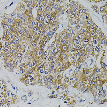 Immunohistochemistry - ARHGEF11 Polyclonal Antibody 