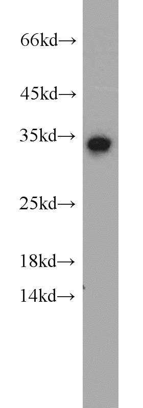 HeLa cells were subjected to SDS PAGE followed by western blot with Catalog No:113806(PHF11 antibody) at dilution of 1:300
