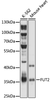 Western blot - FUT2 Polyclonal Antibody 