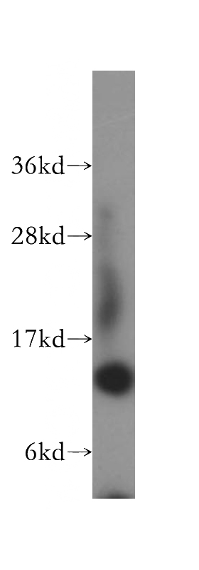 HepG2 cells were subjected to SDS PAGE followed by western blot with Catalog No:114889(RPL31 antibody) at dilution of 1:300