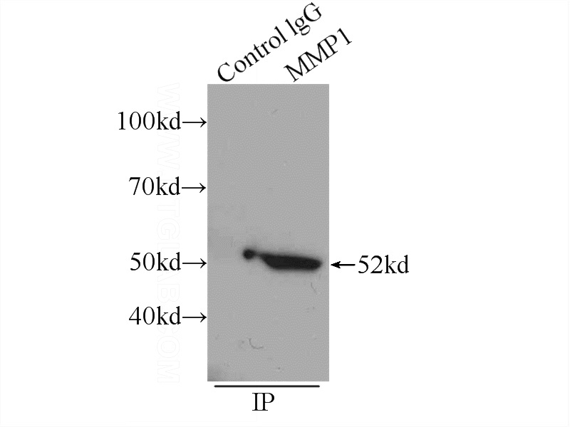 IP Result of anti-MMP1 (IP:Catalog No:112696, 4ug; Detection:Catalog No:112696 1:1000) with A549 cells lysate 1200ug.
