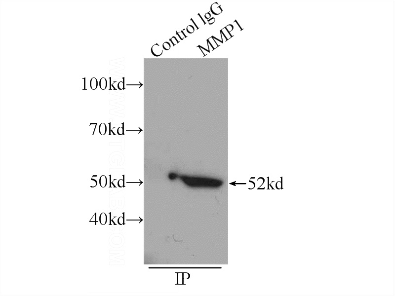 IP Result of anti-MMP1 (IP:Catalog No:112696, 4ug; Detection:Catalog No:112696 1:1000) with A549 cells lysate 1200ug.