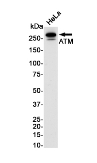 Western blot detection of ATM in Hela cell lysates using ATM Rabbit pAb(1:1000 diluted).Predicted band size:351KDa.Observed band size:351KDa.