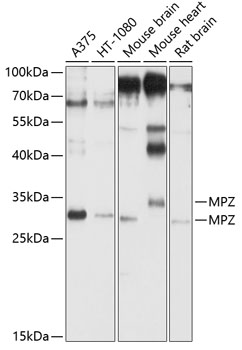 Western blot - MPZ Polyclonal Antibody 