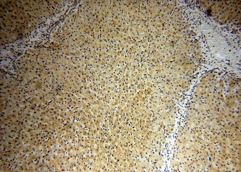Immunohistochemical of paraffin-embedded human liver using Catalog No:110542(FBXL14 antibody) at dilution of 1:50 (under 10x lens)