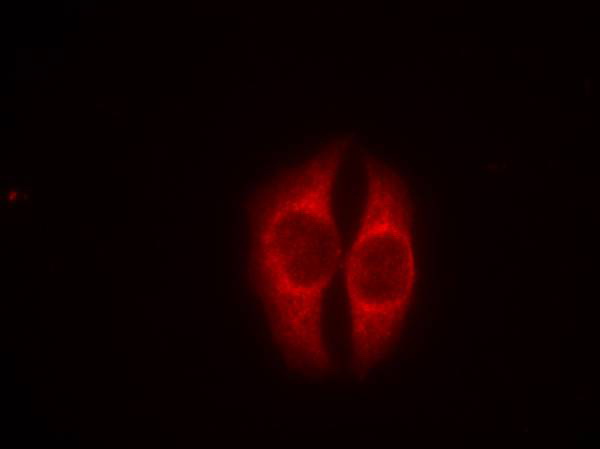 Immunofluorescence staining of methanol-fixed Hela cells using p53 (Phospho-Ser37) Antibody .