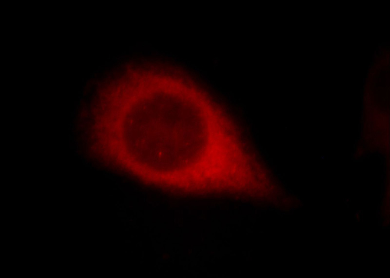 Immunofluorescent analysis of Hela cells, using AHCYL1 antibody Catalog No:107843 at 1:25 dilution and Rhodamine-labeled goat anti-rabbit IgG (red).