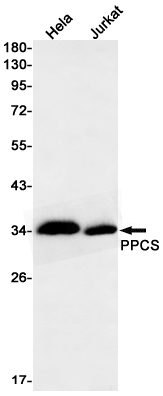 Western blot detection of PPCS in Hela,Jurkat cell lysates using PPCS Rabbit mAb(1:1000 diluted).Predicted band size:34kDa.Observed band size:34kDa.