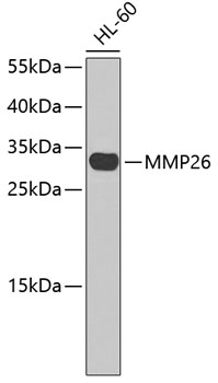 Western blot - MMP26 Polyclonal Antibody 