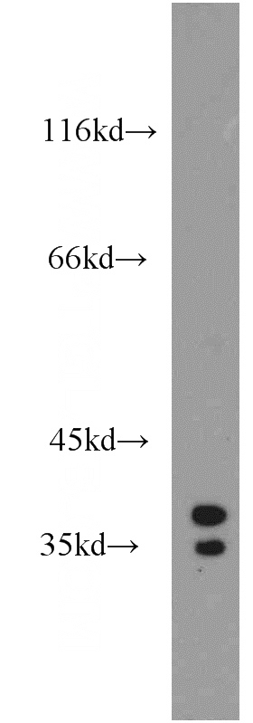 HepG2 cells were subjected to SDS PAGE followed by western blot with Catalog No:115677(STARD10 antibody) at dilution of 1:1500