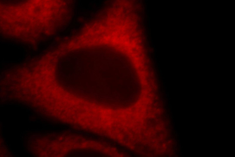 Immunofluorescent analysis of HepG2 cells, using EEF2 antibody Catalog No:110316 at 1:25 dilution and Rhodamine-labeled goat anti-rabbit IgG (red).