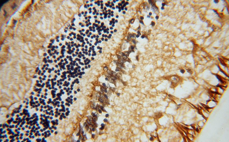 Immunohistochemical of paraffin-embedded human eye using Catalog No:114719(RLBP1 antibody) at dilution of 1:50 (under 40x lens)