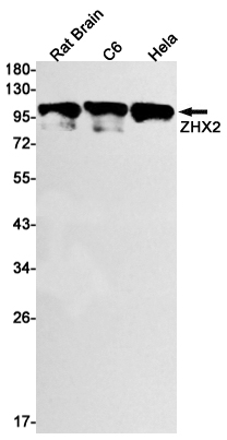 Western blot detection of ZHX2 in Rat Brain,C6,Hela cell lysates using ZHX2 Rabbit mAb(1:1000 diluted).Predicted band size:92kDa.Observed band size:110kDa.