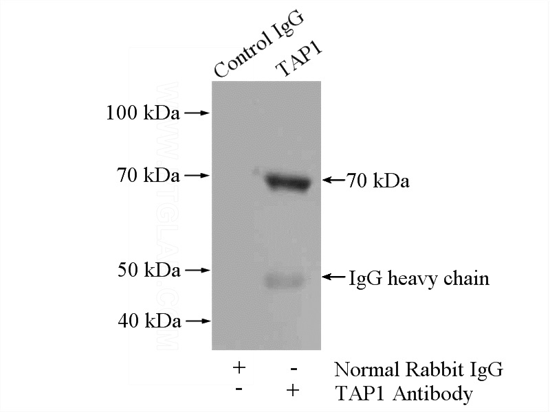 IP Result of anti-TAP1 (IP:Catalog No:115850, 4ug; Detection:Catalog No:115850 1:500) with HepG2 cells lysate 2400ug.