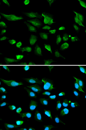 Immunofluorescence - AIRE Polyclonal Antibody 