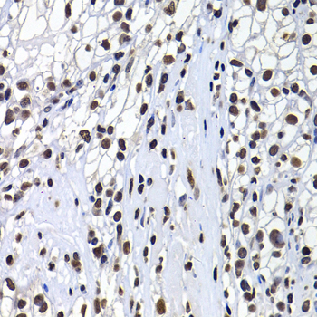 Immunohistochemistry - mH2A1 Polyclonal Antibody 