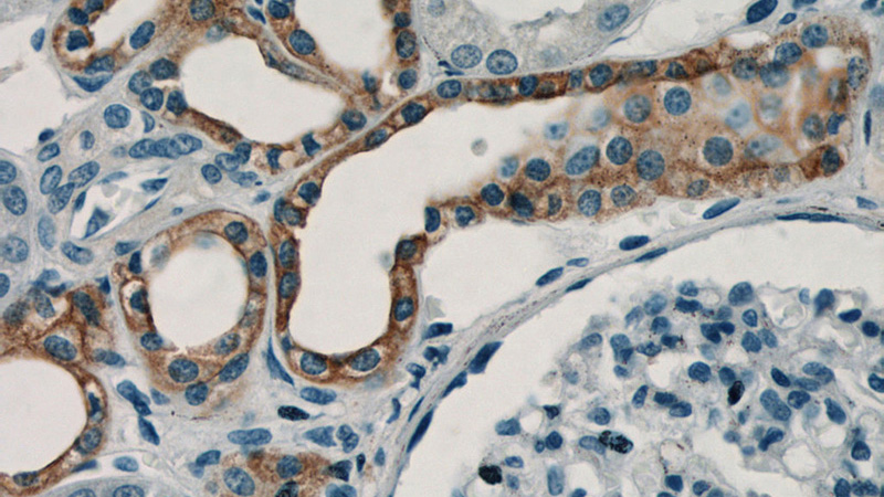 Immunohistochemistry of paraffin-embedded human kidney tissue slide using Catalog No:115179(SH2D1B Antibody) at dilution of 1:50 (under 40x lens)