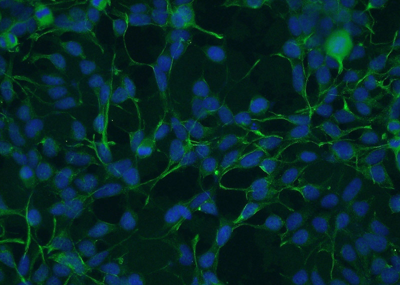 Immunofluorescent analysis of HEK-293 cells using Catalog No:107030(CA9 Antibody) at dilution of 1:50 and Alexa Fluor 488-congugated AffiniPure Goat Anti-Mouse IgG(H+L)