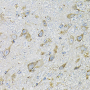 Immunohistochemistry - PDYN Polyclonal Antibody 