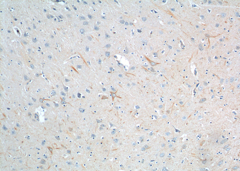 Immunohistochemistry of paraffin-embedded human brain tissue slide using Catalog No:113910(PINK1 Antibody) at dilution of 1:50 (under 10x lens).