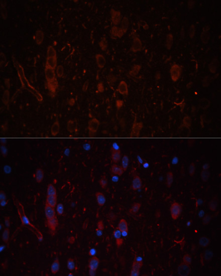 Immunofluorescence - LAMC1 Polyclonal Antibody 