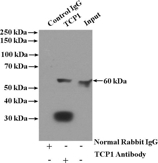 IP Result of anti-TCP1 (IP:Catalog No:115915, 4ug; Detection:Catalog No:115915 1:300) with HeLa cells lysate 1600ug.