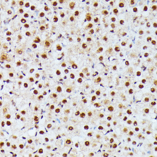Immunohistochemistry - ID2 Polyclonal Antibody 