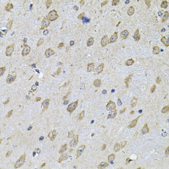 Immunohistochemistry - NFU1 Polyclonal Antibody 