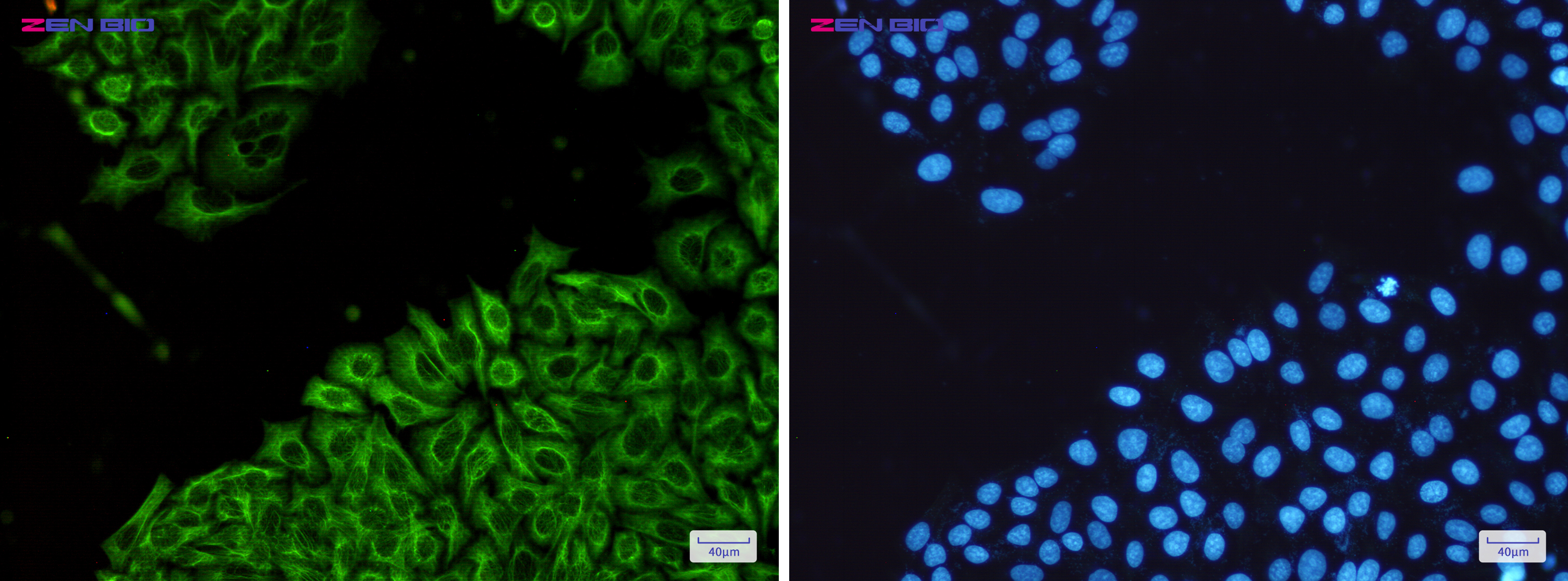 Immunocytochemistry of Cytokeratin 18(green) in Hela cells using Cytokeratin 18 Rabbit pAb at dilution 1/50, and DAPI(blue)