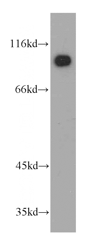 mouse lung tissue were subjected to SDS PAGE followed by western blot with Catalog No:111909(KANK2 antibody) at dilution of 1:800