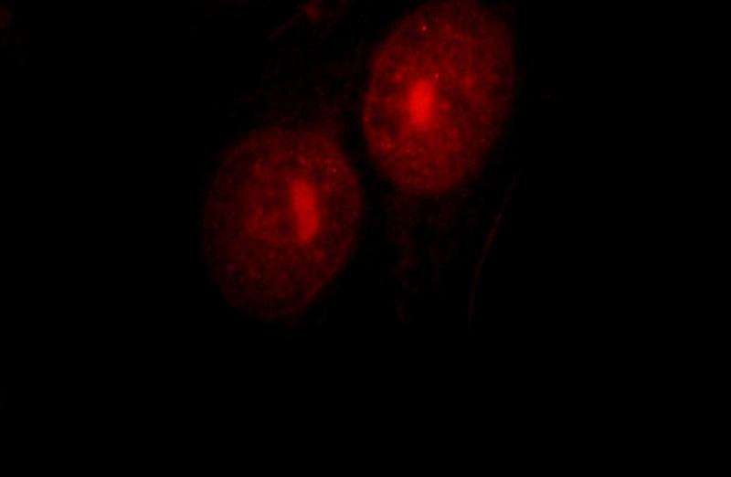 Immunofluorescent analysis of HepG2 cells, using UBE2E2 antibody Catalog No:116522 at 1:25 dilution and Rhodamine-labeled goat anti-rabbit IgG (red).