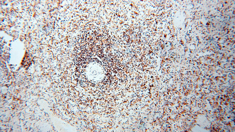 Immunohistochemical of paraffin-embedded human spleen using Catalog No:117147(BIN2 antibody) at dilution of 1:100 (under 10x lens)