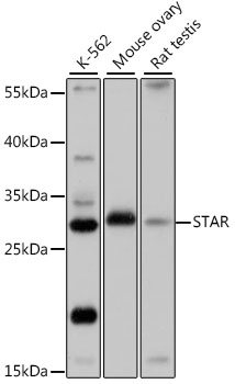 Western blot - STAR Polyclonal Antibody 