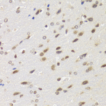Immunohistochemistry - BAZ1B Polyclonal Antibody 
